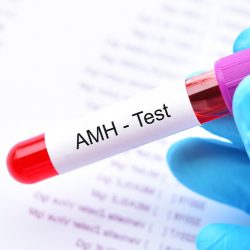 A termékenység mutató - Anti Müller hormon (AMH)