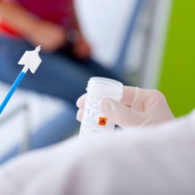 HPV fertőzés és HPV tesztelés férfiaknál
